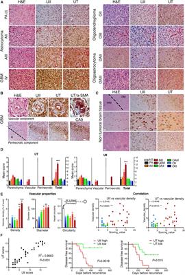 Targeting the Urotensin II/UT G Protein-Coupled Receptor to Counteract Angiogenesis and Mesenchymal Hypoxia/Necrosis in Glioblastoma